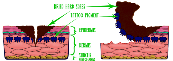 Scabs and how they affect a new tattoo